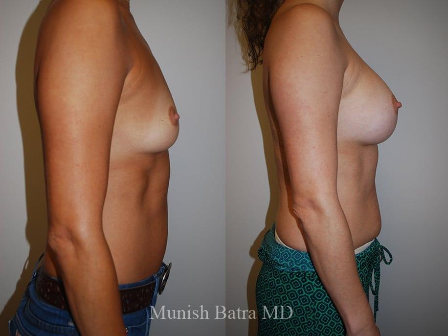 Before and After Image