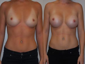 Before and After Image