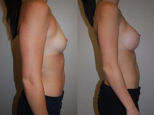 Before and After Image