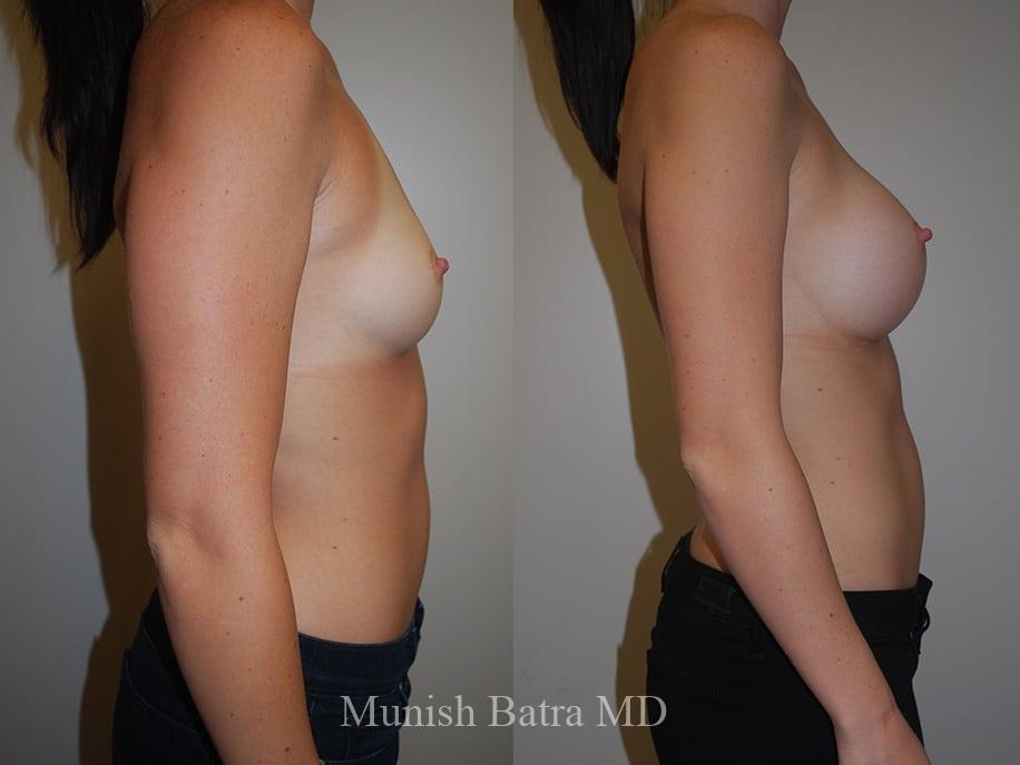 Before and After Image