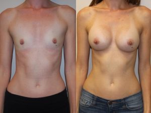 Before and After Image