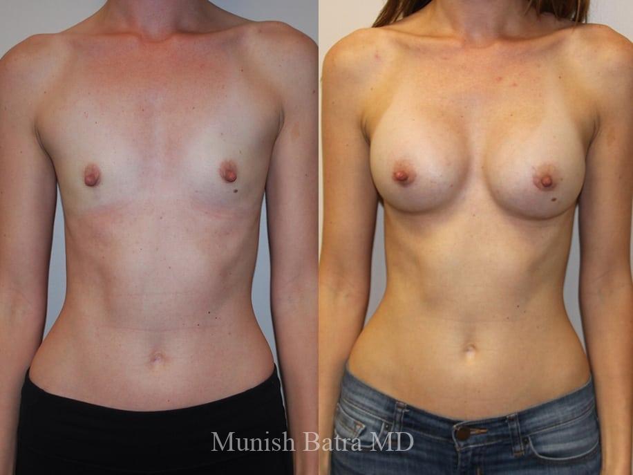 Before and After Image