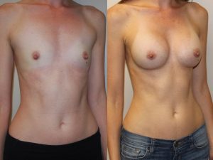 Before and After Image
