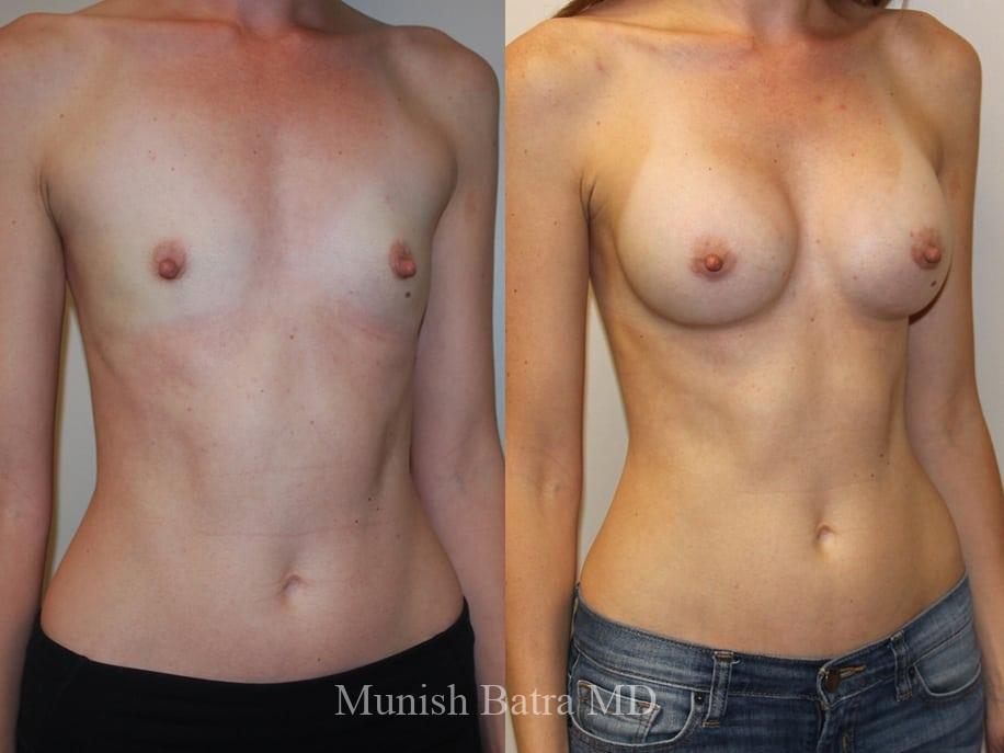 Before and After Image