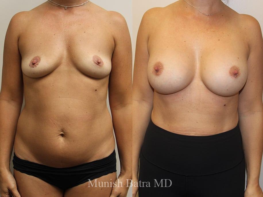 Before and After Image