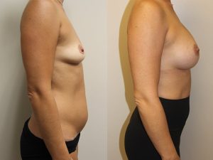 Before and After Image