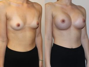Before and After Image