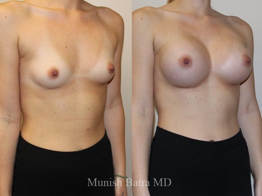 Before and After Image