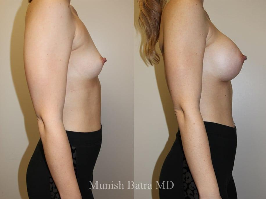 Before and After Image
