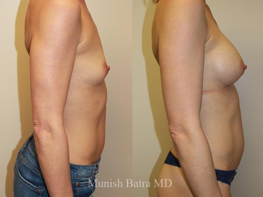 Before and After Image