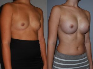 Before and After Image