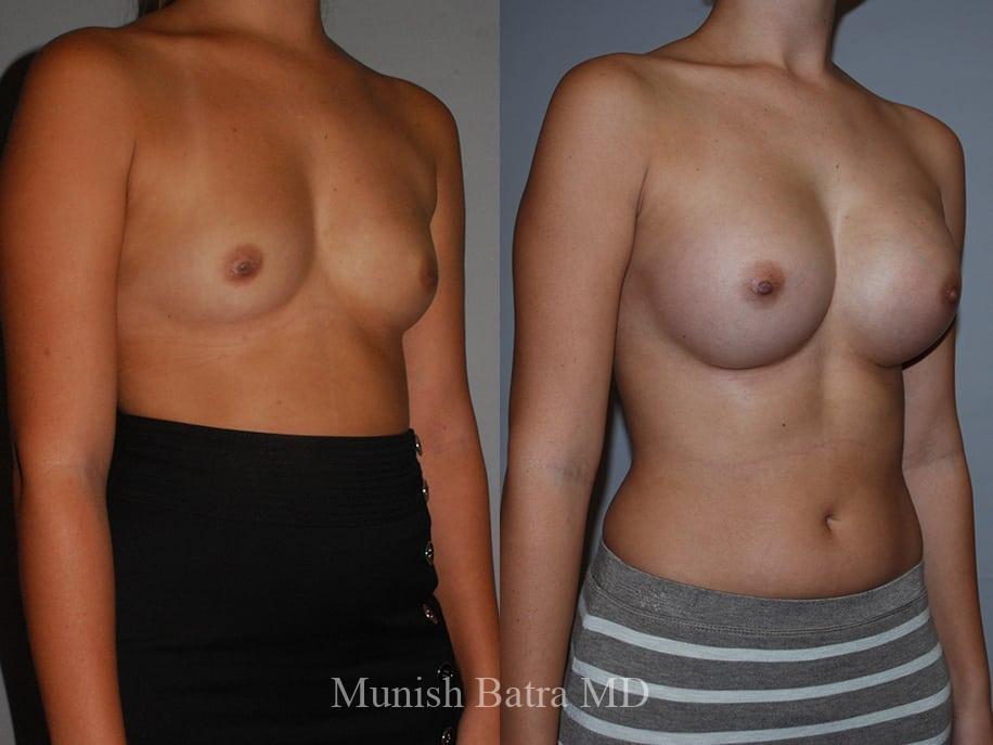 Before and After Image
