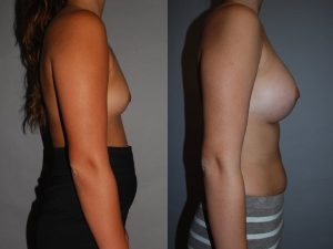 Before and After Image