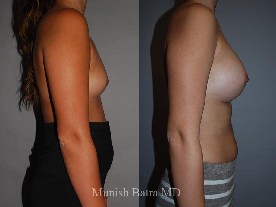 Before and After Image