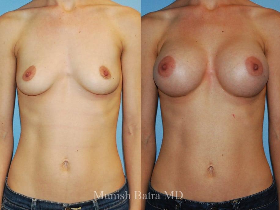 Before and After Image