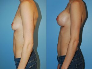 Before and After Image