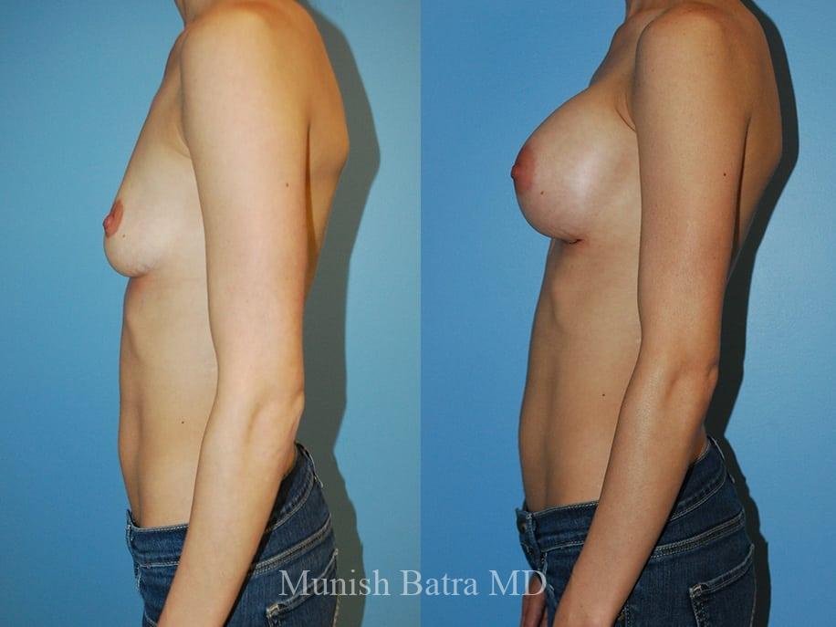 Before and After Image