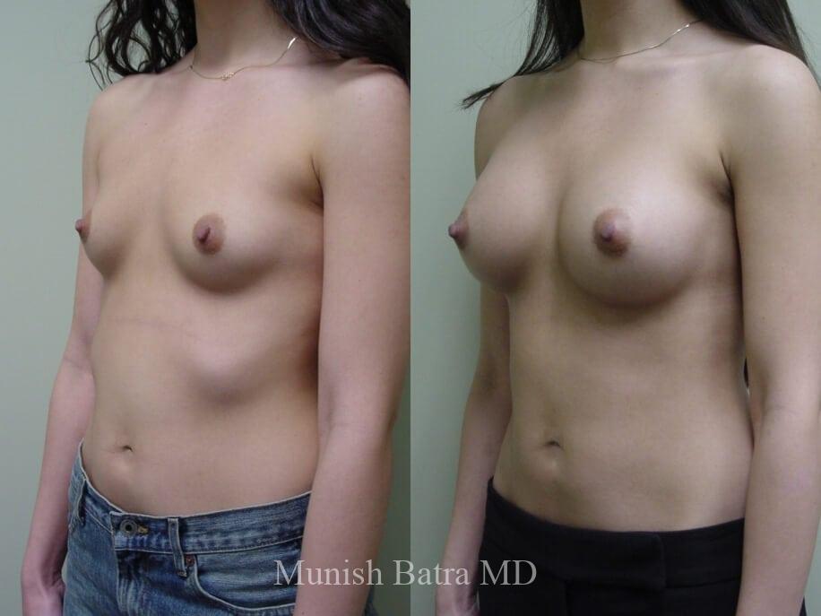 Before and After Image