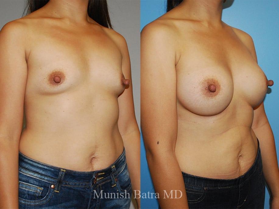 Before and After Image