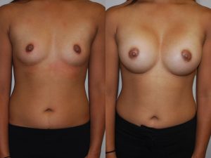 Before and After Image