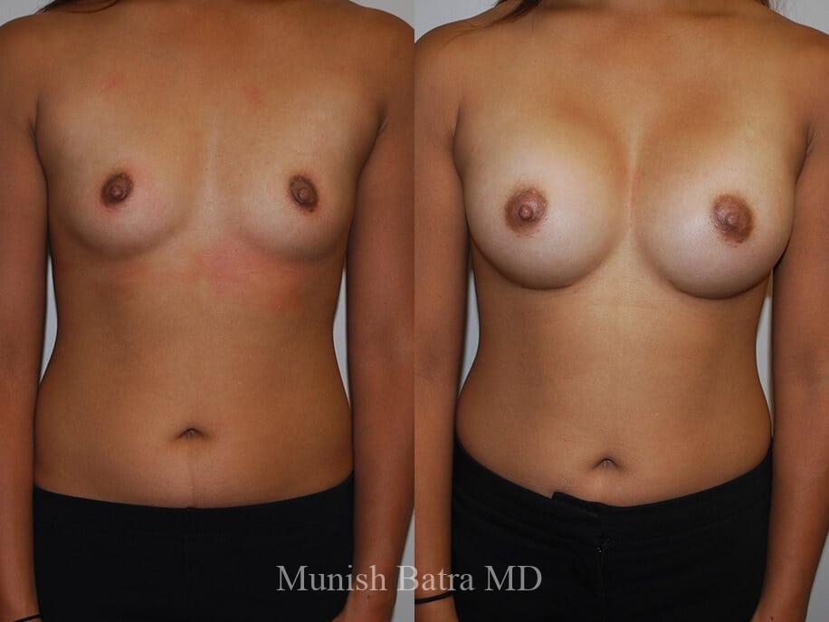 Before and After Image