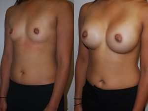 Before and After Image