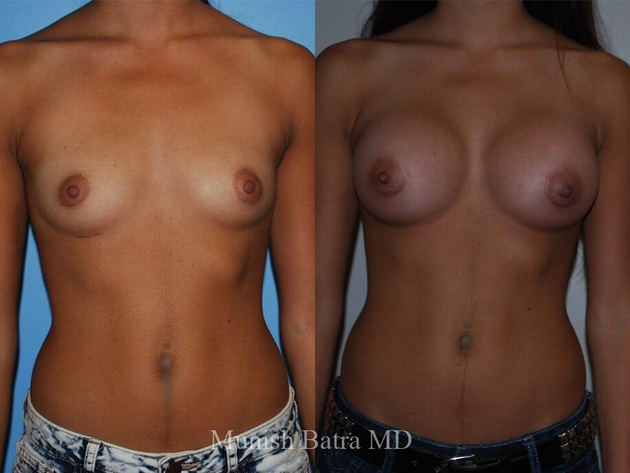 Before and After Image