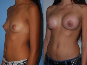 Before and After Image