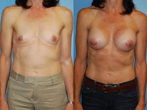 Before and After Image