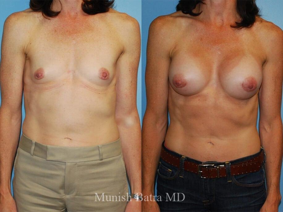 Before and After Image