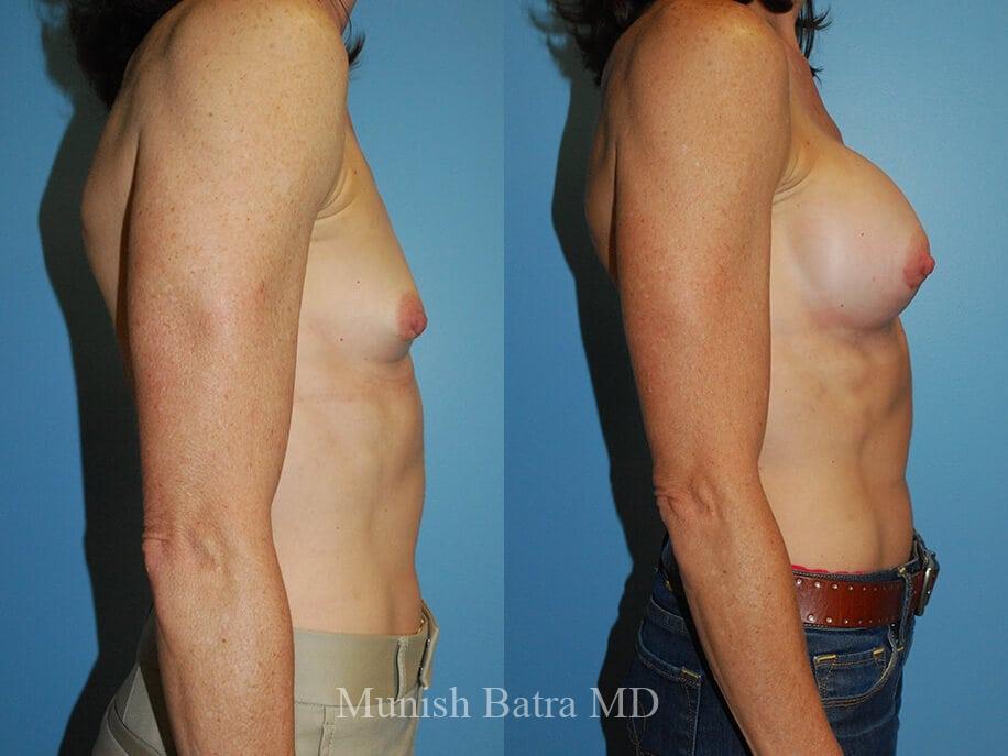 Before and After Image