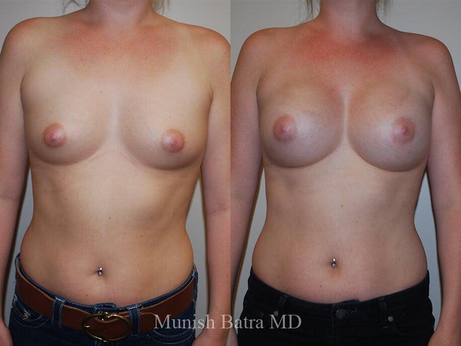 Before and After Image