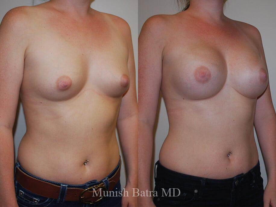 Before and After Image