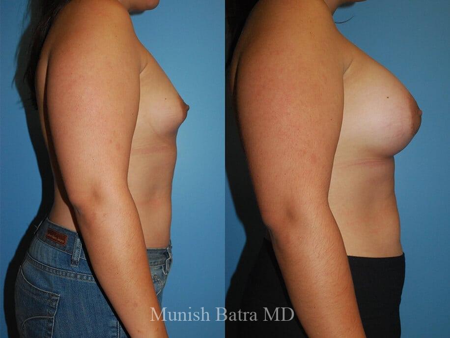 Before and After Image
