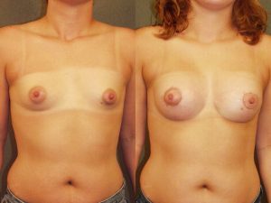 Before and After Image