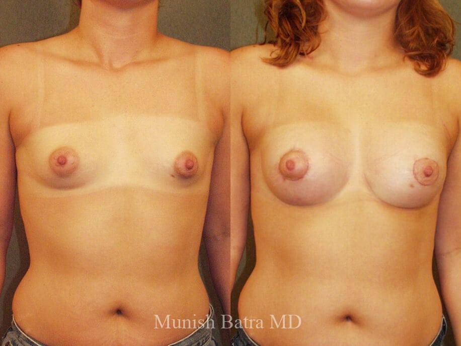 Before and After Image