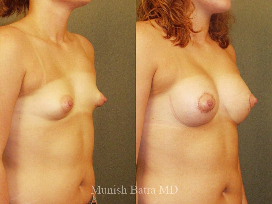 Before and After Image