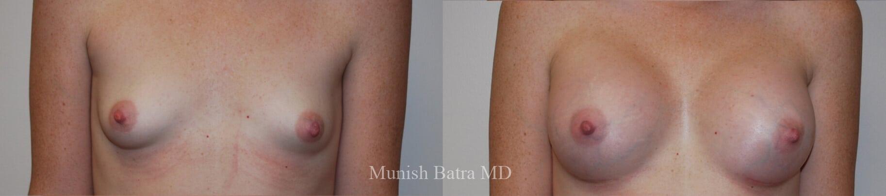 Before and After Image