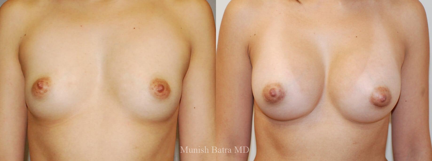 Before and After Image