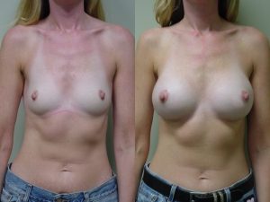 Before and After Image