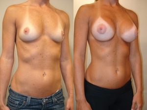 Before and After Image