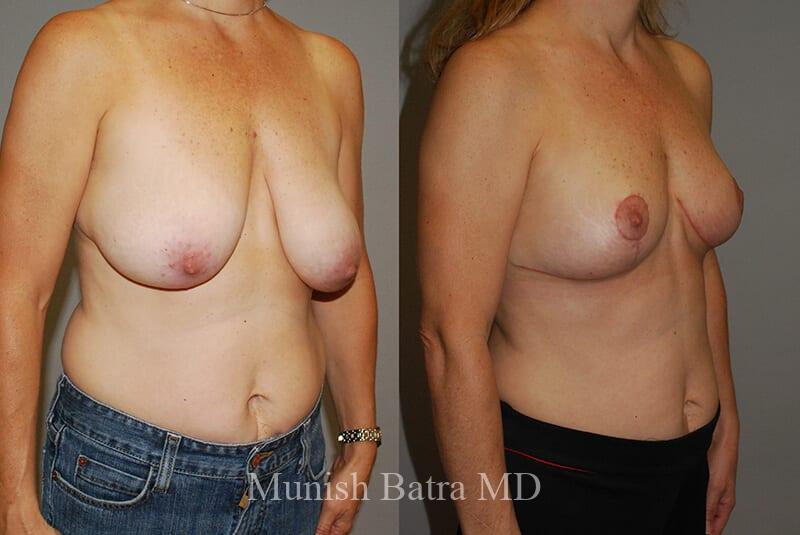 Before and After Image
