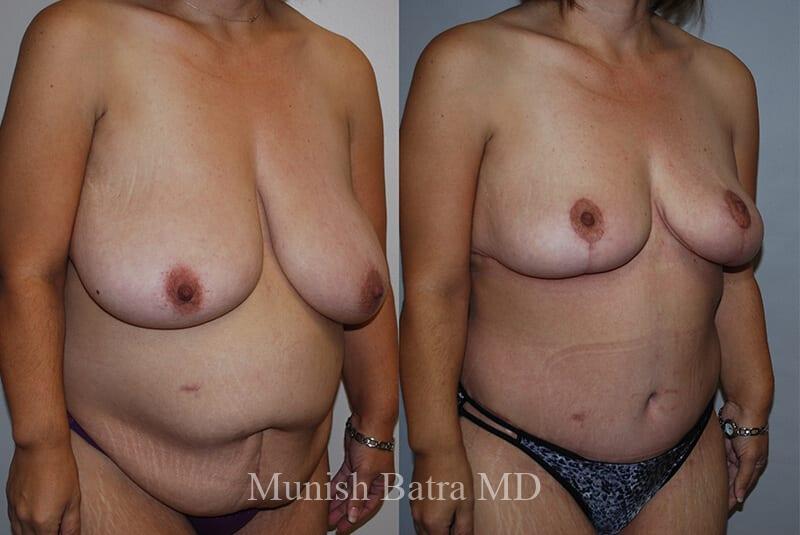 Before and After Image