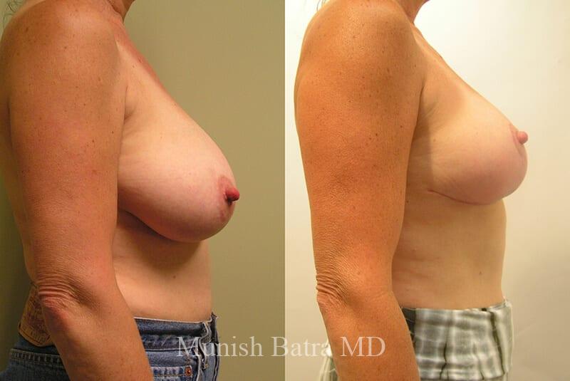 Before and After Image