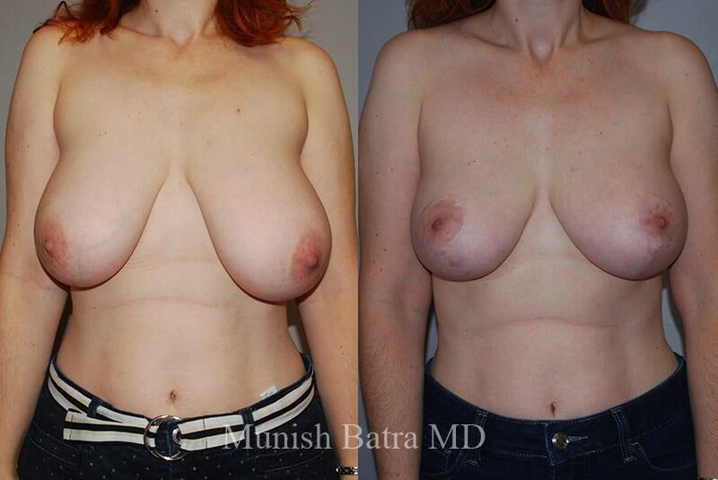 Before and After Image