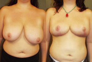 Before and After Image