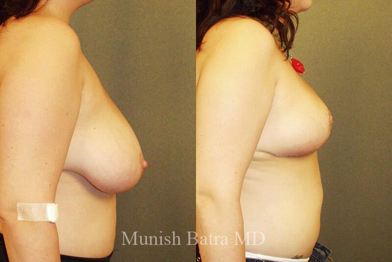 Before and After Image