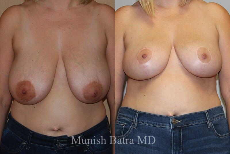 Before and After Image