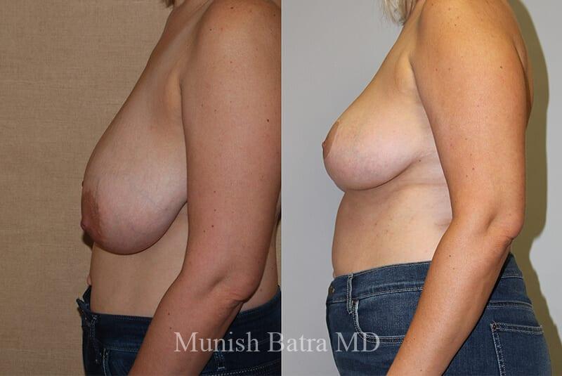 Before and After Image
