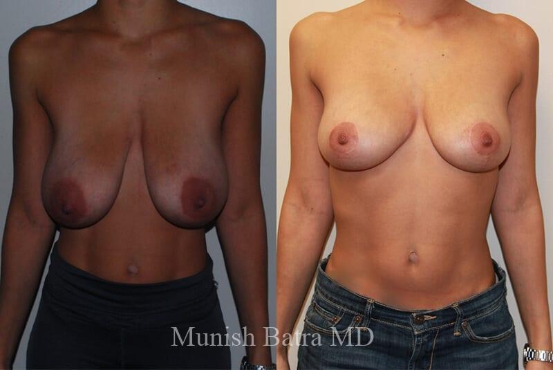 Before and After Image